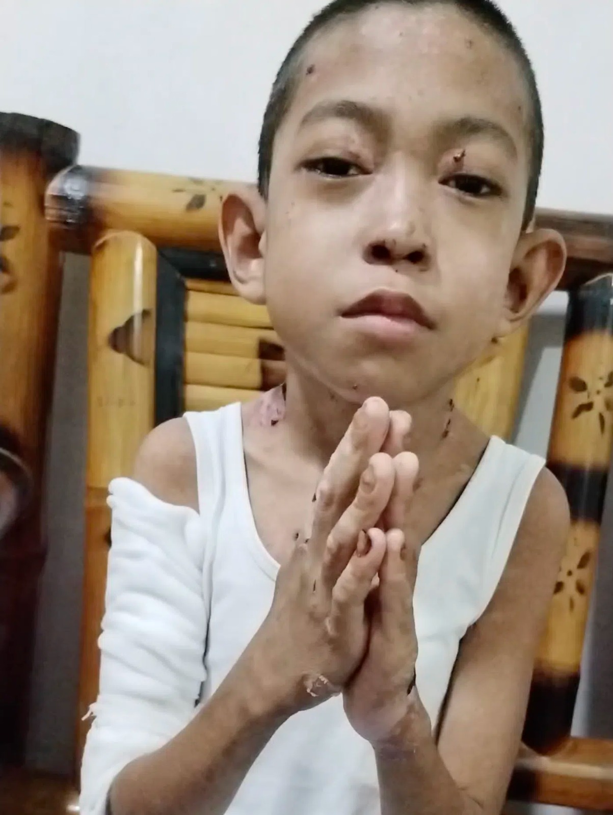 Please Donate to Stop Mark's Severe Pain and Help Save His Life