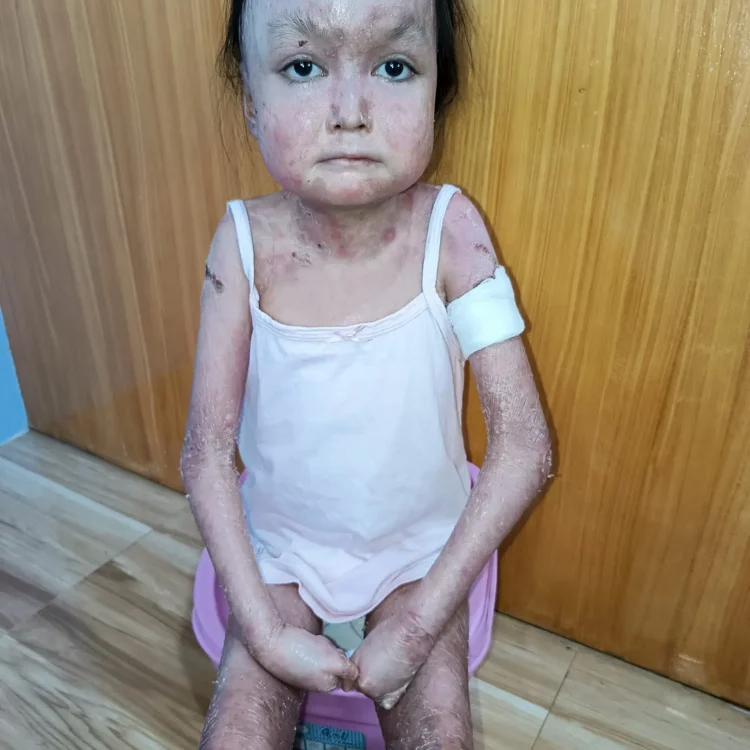 Please Donate to Stop Shamila's Severe Pain and Help Save Her Life