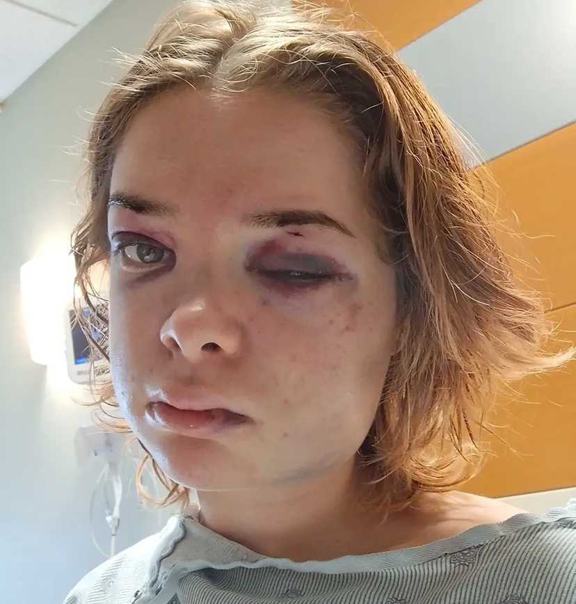Support Liya’s Recovery and Safety
